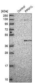 Western blot analysis in control (vector only transfected HEK293T lysate) and PPM1L over-expression lysate (Co-expressed with a C-terminal myc-DDK tag (~3.1 kDa) in mammalian HEK293T cells, LY408320).