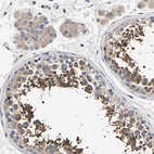 Immunohistochemical staining of human testis shows high expression.