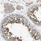 Immunohistochemical staining of human testis shows high expression.