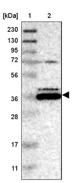 Lane 1: Marker [kDa] 230, 130, 95, 72, 56, 36, 28, 17, 11_br/_Lane 2: Human cell line RT-4