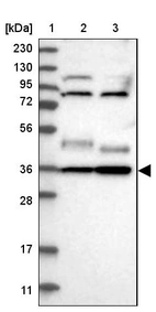Lane 1: Marker [kDa] 230, 130, 95, 72, 56, 36, 28, 17, 11_br/_Lane 2: Human cell line RT-4_br/_Lane 3: Human cell line U-251MG sp