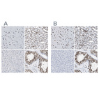 Anti-CCAR2 Antibody