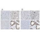 Immunohistochemical staining of human cerebral cortex, kidney, liver and testis using Anti-CCAR2 antibody HPA019907 (A) shows similar protein distribution across tissues to independent antibody HPA019943 (B).