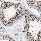 Immunohistochemical staining of human testis shows strong nuclear positivity in cells in seminiferous ducts.