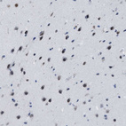 Immunohistochemical staining of human cerebral cortex shows strong nuclear positivity in neurons.