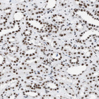 Anti-CCAR2 Antibody