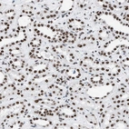 Immunohistochemical staining of human kidney shows strong nuclear positivity in cells in tubules.