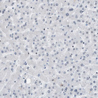 Anti-CCAR2 Antibody