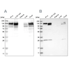 Western blot analysis using Anti-CCAR2 antibody HPA019907 (A) shows similar pattern to independent antibody HPA019943 (B).