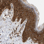 Immunohistochemical staining of human skin shows strong cytoplasm positivity in squamous epithelial cells.