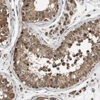 Immunohistochemical staining of human testis shows strong cytoplasm positivity in cells in seminiferous ducts.