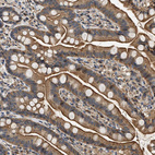 Immunohistochemical staining of human small intestine shows strong cytoplasmic and membranous positivity in glandular cells.