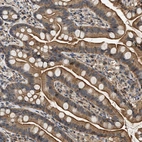 Immunohistochemical staining of human small intestine shows strong cytoplasmic and membranous positivity in glandular cells.