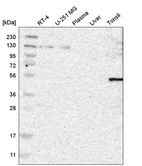 Anti-CSRNP2 Antibody