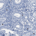 Immunohistochemical staining of human endometrium shows strong cytoplasmic positivity in lymphocytes.