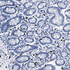 Immunohistochemical staining of human duodenum shows strong cytoplasmic positivity in lymphocytes.
