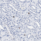 Immunohistochemical staining of human kidney shows strong cytoplasmic positivity in lymphocytes.