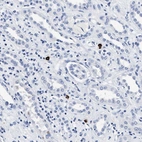Immunohistochemical staining of human kidney shows strong cytoplasmic positivity in lymphocytes.