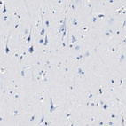 Immunohistochemical staining of human cerebral cortex shows no positivity as expected.