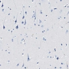 Immunohistochemical staining of human cerebral cortex shows no positivity as expected.