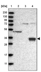 Lane 1: Marker [kDa] 230, 130, 95, 72, 56, 36, 28, 17, 11_br/_Lane 2: Human cell line RT-4_br/_Lane 3: Human cell line U-251MG sp_br/_Lane 4: Human plasma (IgG/HSA depleted)
