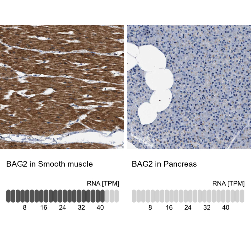 Anti-BAG2 Antibody