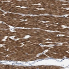 Immunohistochemical staining of human Smooth muscle shows strong cytoplasmic positivity in smooth muscle cells.