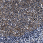 Immunohistochemical staining of human Lymph node shows moderate cytoplasmic positivity in germinal center cells.