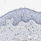 Immunohistochemical staining of human Skin shows no positivity in squamous epithelial cells as expected.