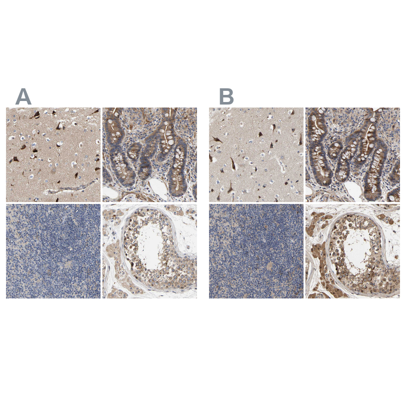 Anti-CCDC155 Antibody