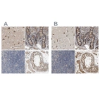 Anti-CCDC155 Antibody