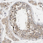 Immunohistochemical staining of human testis shows moderate cytoplasmic positivity in cells in seminiferous ducts and in leydig cells.