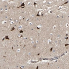 Immunohistochemical staining of human cerebral cortex shows strong cytoplasmic positivity in neurons.