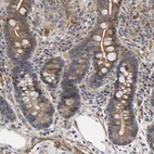 Immunohistochemical staining of human colon shows strong cytoplasmic positivity in glandular cells.