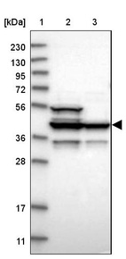 Lane 1: Marker [kDa] 230, 130, 95, 72, 56, 36, 28, 17, 11_br/_Lane 2: Human cell line RT-4_br/_Lane 3: Human cell line U-251MG sp