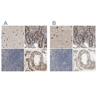 Anti-CCDC155 Antibody