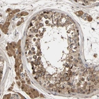 Immunohistochemical staining of human testis shows strong cytoplasmic positivity in cells in seminiferous ducts and leydig cells.