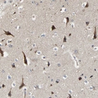 Immunohistochemical staining of human cerebral cortex shows strong cytoplasmic positivity in neurons.