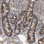 Immunohistochemical staining of human colon shows strong cytoplasmic positivity in glandular cells.