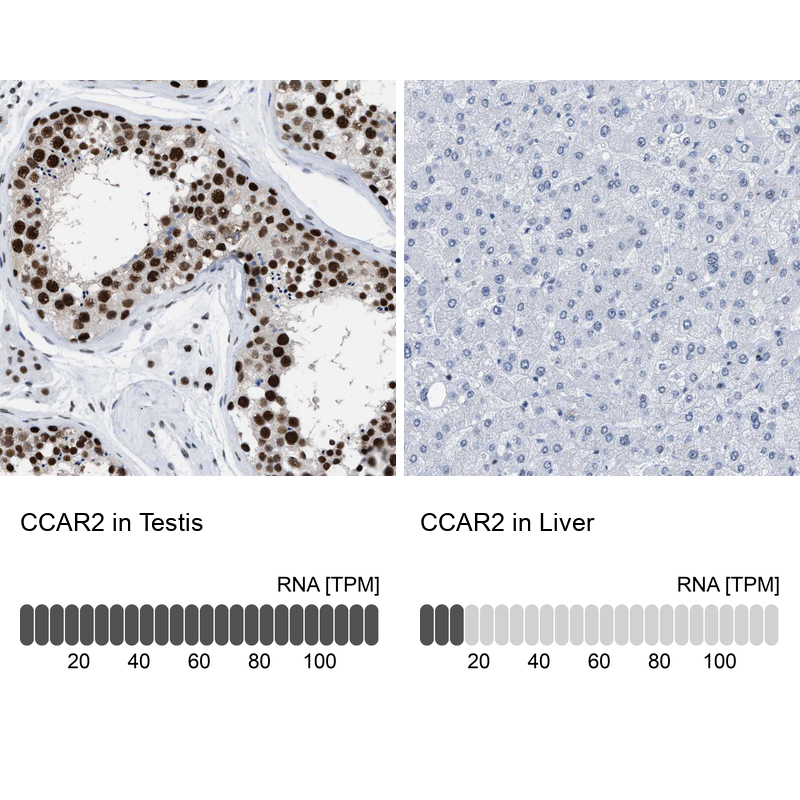 Anti-CCAR2 Antibody