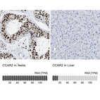 Anti-CCAR2 Antibody