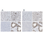 Immunohistochemical staining of human cerebral cortex, kidney, liver and testis using Anti-CCAR2 antibody HPA019943 (A) shows similar protein distribution across tissues to independent antibody HPA019907 (B).