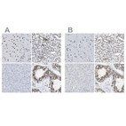 Immunohistochemical staining of human cerebral cortex, kidney, liver and testis using Anti-CCAR2 antibody HPA019943 (A) shows similar protein distribution across tissues to independent antibody HPA019907 (B).