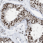 Immunohistochemical staining of human testis shows strong nuclear positivity in cells in seminiferous ducts.