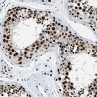 Immunohistochemical staining of human testis shows strong nuclear positivity in cells in seminiferous ducts.