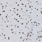 Immunohistochemical staining of human cerebral cortex shows strong nuclear positivity in neurons.