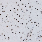Immunohistochemical staining of human cerebral cortex shows strong nuclear positivity in neurons.