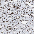 Immunohistochemical staining of human kidney shows strong nuclear positivity in cells in tubules.