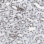 Immunohistochemical staining of human kidney shows strong nuclear positivity in cells in tubules.