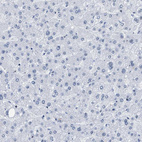 Immunohistochemical staining of human liver shows very weak nuclear positivity in hepatocytes.